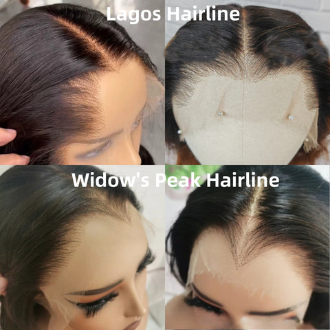 Hairline Customization